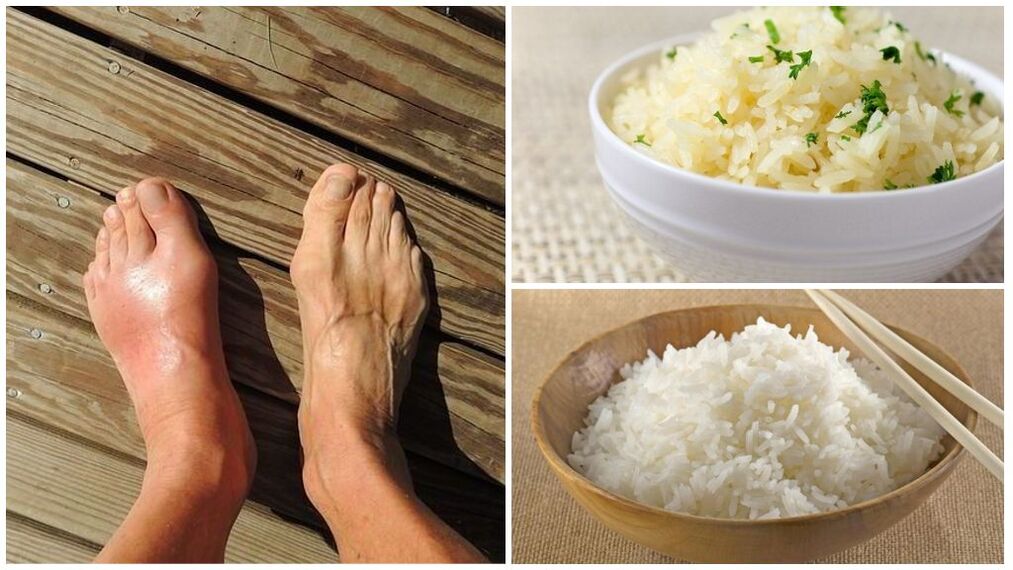 ينصح باتباع نظام غذائي يعتمد على الأرز لمرضى النقرس. 